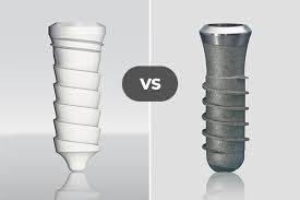 Titanio Vs Zirconia