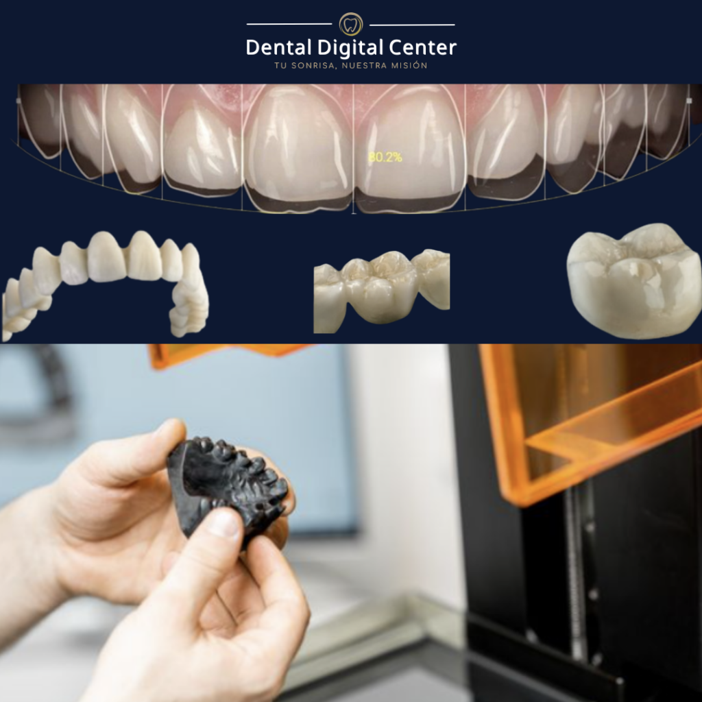 Implantes e Impresion 3d de coronas y puentes
