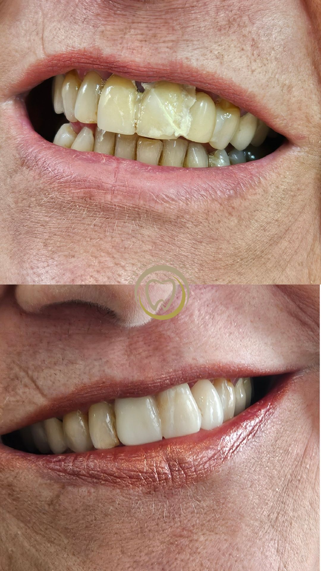De Mar del Plata al Obelisco: Cómo Solucionar una Urgencia Dental en 24 Horas